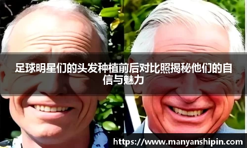 足球明星们的头发种植前后对比照揭秘他们的自信与魅力